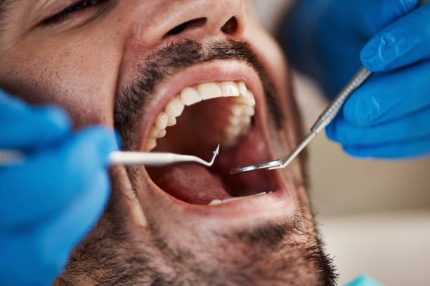 Tooth Infection Emergency Dentist in IL